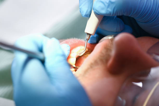 Best Emergency Tooth Extraction  in Eddyville, IA